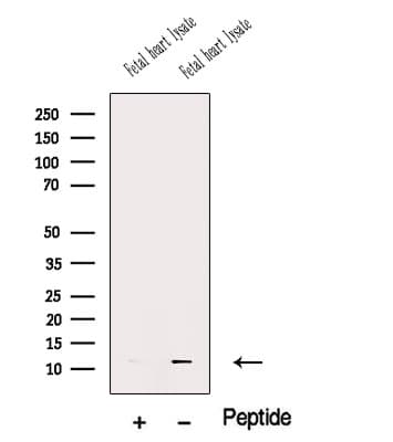 CCL8 / MCP2 Antibody