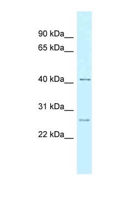 Polyclonal Rabbit anti-Human CCNK Antibody (aa133-182, WB)
