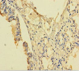 Polyclonal Rabbit anti-Human POP4 Antibody (aa1-220)