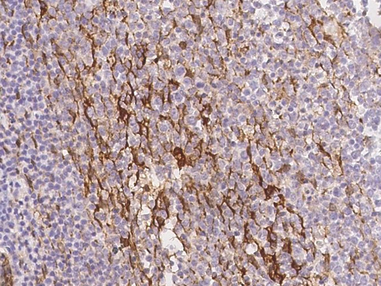 HSPB1 / HSP27 Antibody (Preservative Free)