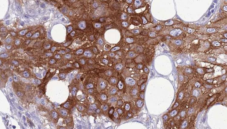 Polyclonal Rabbit anti-Human ITGAX / CD11c Antibody (IHC, WB)
