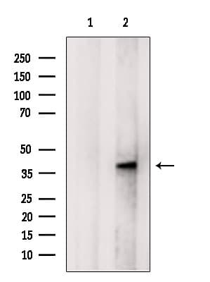 B3GNT3 / TMEM3 Antibody