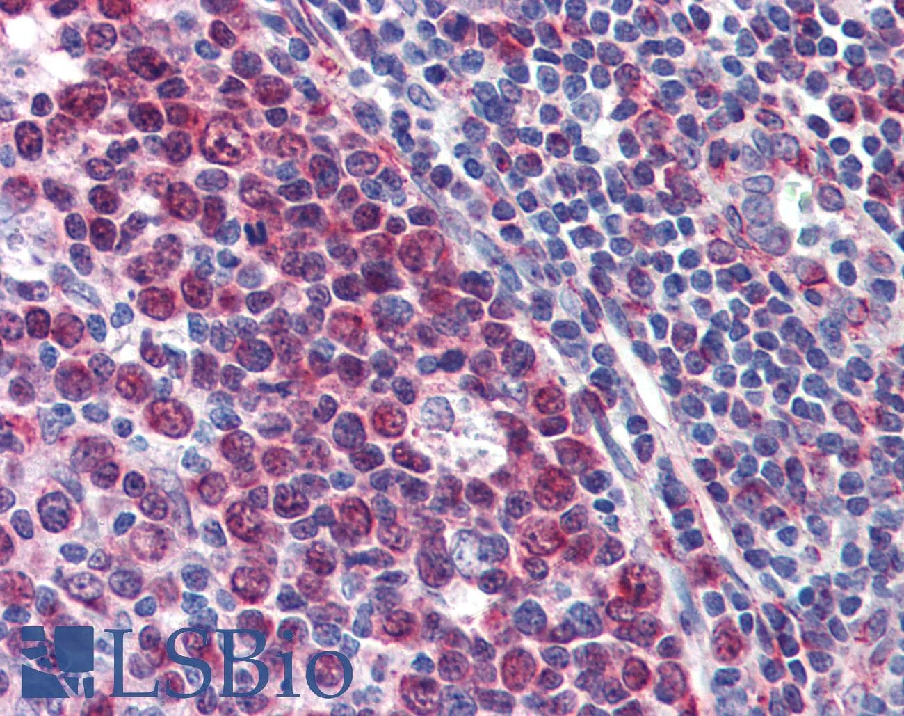IHC-plus™ Polyclonal Rabbit anti-Human KDM1A / LSD1 Antibody (IHC, IF, WB)