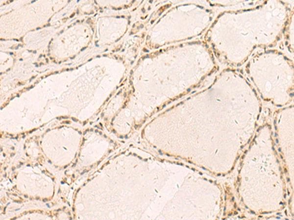 Polyclonal Rabbit anti-Human RFX6 Antibody (IHC)