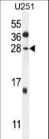 GGTLC2 Antibody (aa127-154)