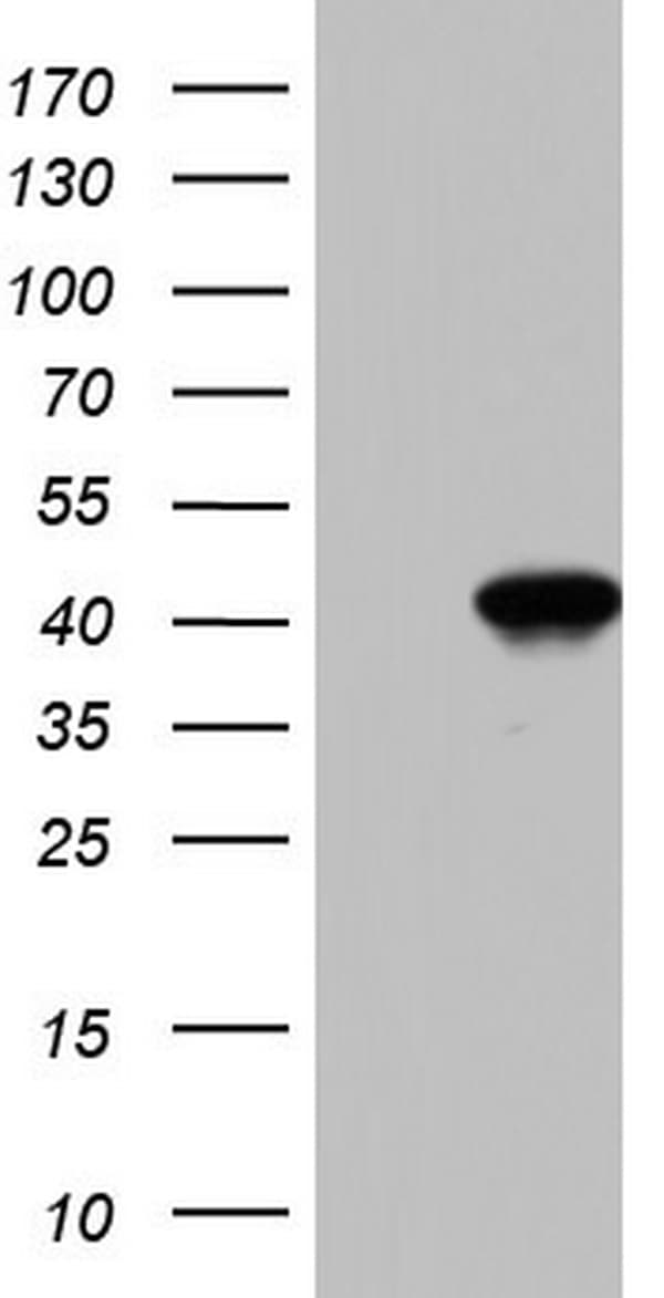 BFSP2 Antibody (aa184-415, clone OTI1D9)