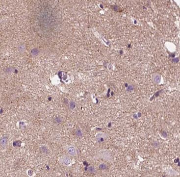 APC Antibody