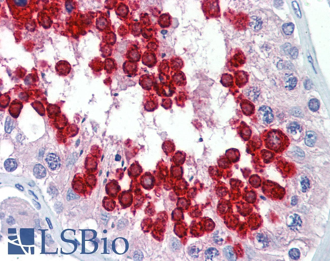 JAZF1 Antibody (C-Terminus)