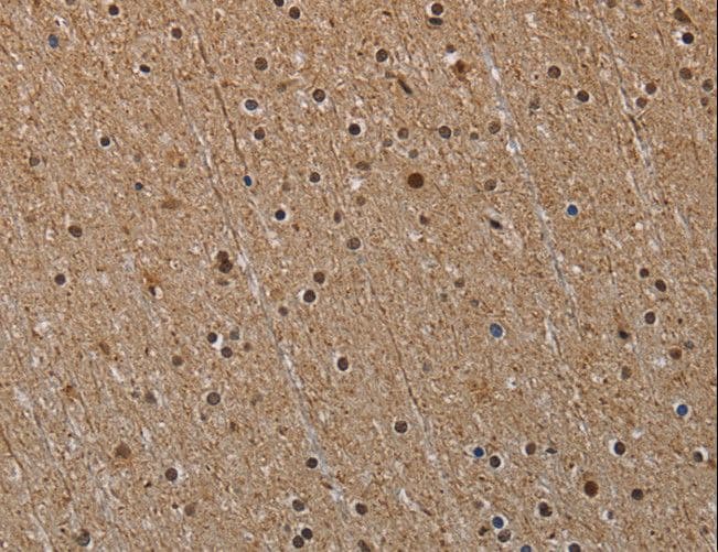 NALP6 / NLRP6 Antibody