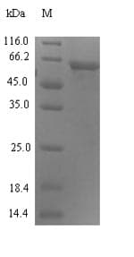 Human ERVWE1 / HERV / Syncytin Protein (Recombinant 6His-SUMO, N-terminus)