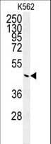 Polyclonal Rabbit anti-Human G6PC / Glucose-6-Phosphatase Antibody (aa123-149, IHC, WB)