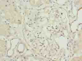 Polyclonal Rabbit anti-Human TPPP2 Antibody (IHC, WB)