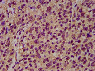 NRCAM Antibody