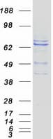 Human RHPN2 Protein (Recombinant Myc-DDK (Flag))