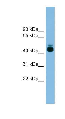 Polyclonal Rabbit anti-Human GPR87 Antibody (aa251-300, WB)