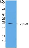 Human IL20 Protein (Recombinant His, N-Terminal)