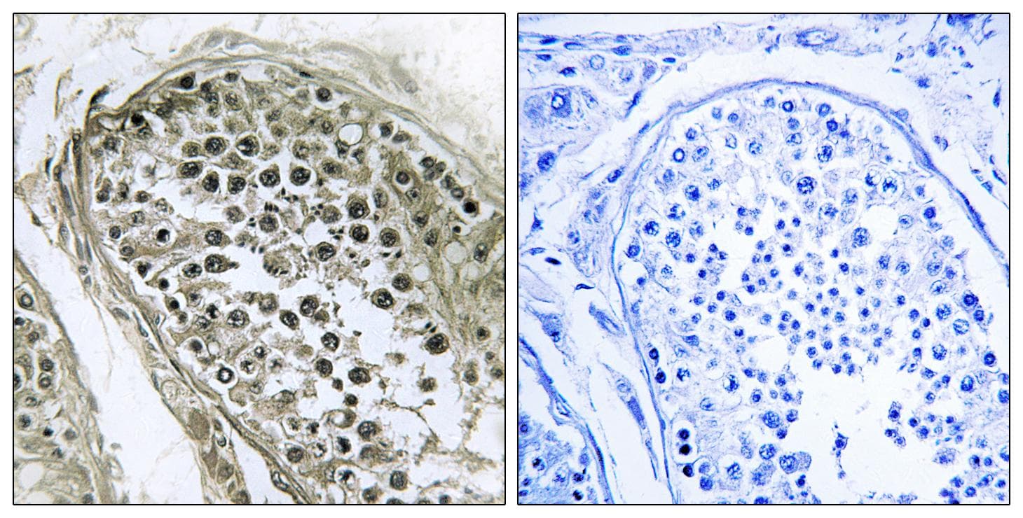 GAB4 Antibody