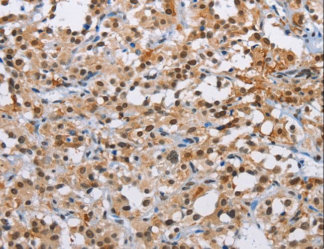 ATXN1 / SCA1 Antibody