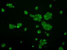 Monoclonal Mouse anti-Human LOX / Lysyl Oxidase Antibody (clone OTI6B11, IHC, IF, WB)