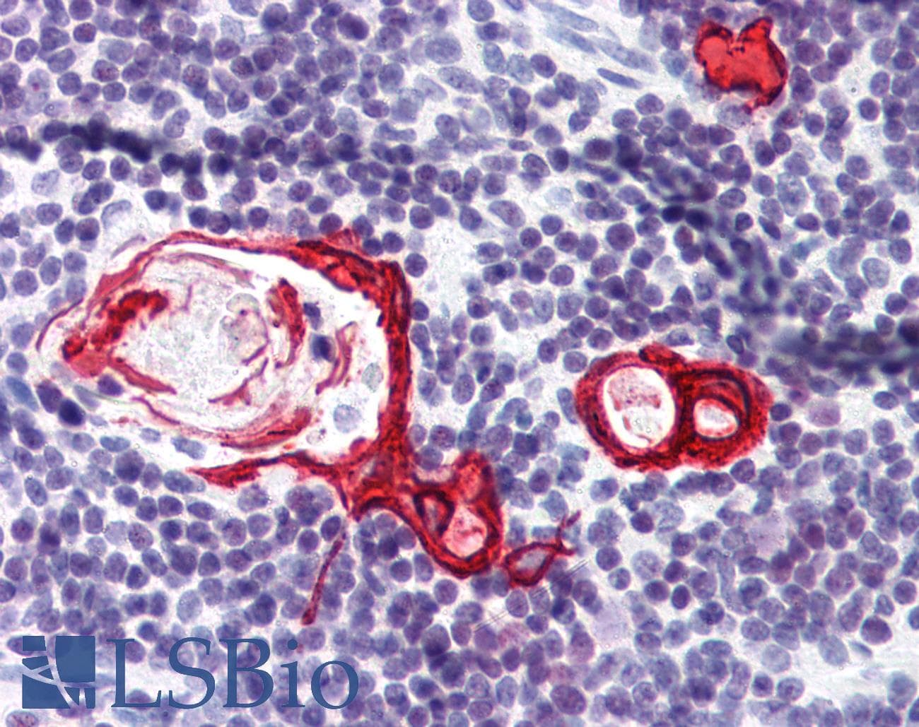 IHC-plus™ KRT10 / CK10 / Cytokeratin 10 Antibody (clone AE20)