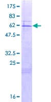 Human CLYBL Protein (Recombinant GST)