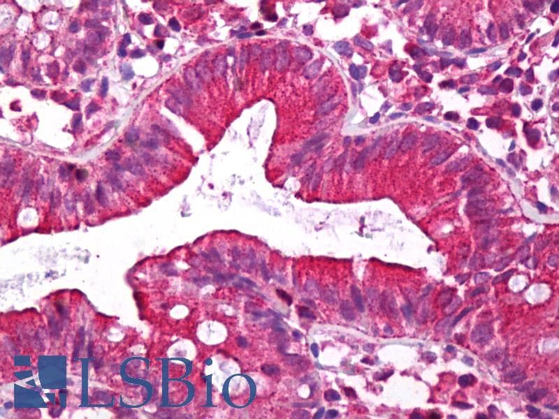 IHC-plus™ DISC1 Antibody (aa400-500)