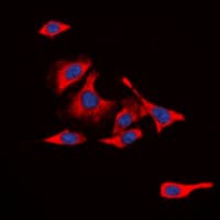 IL13RA1 / IL13R Alpha 1 Antibody (C-Terminus)