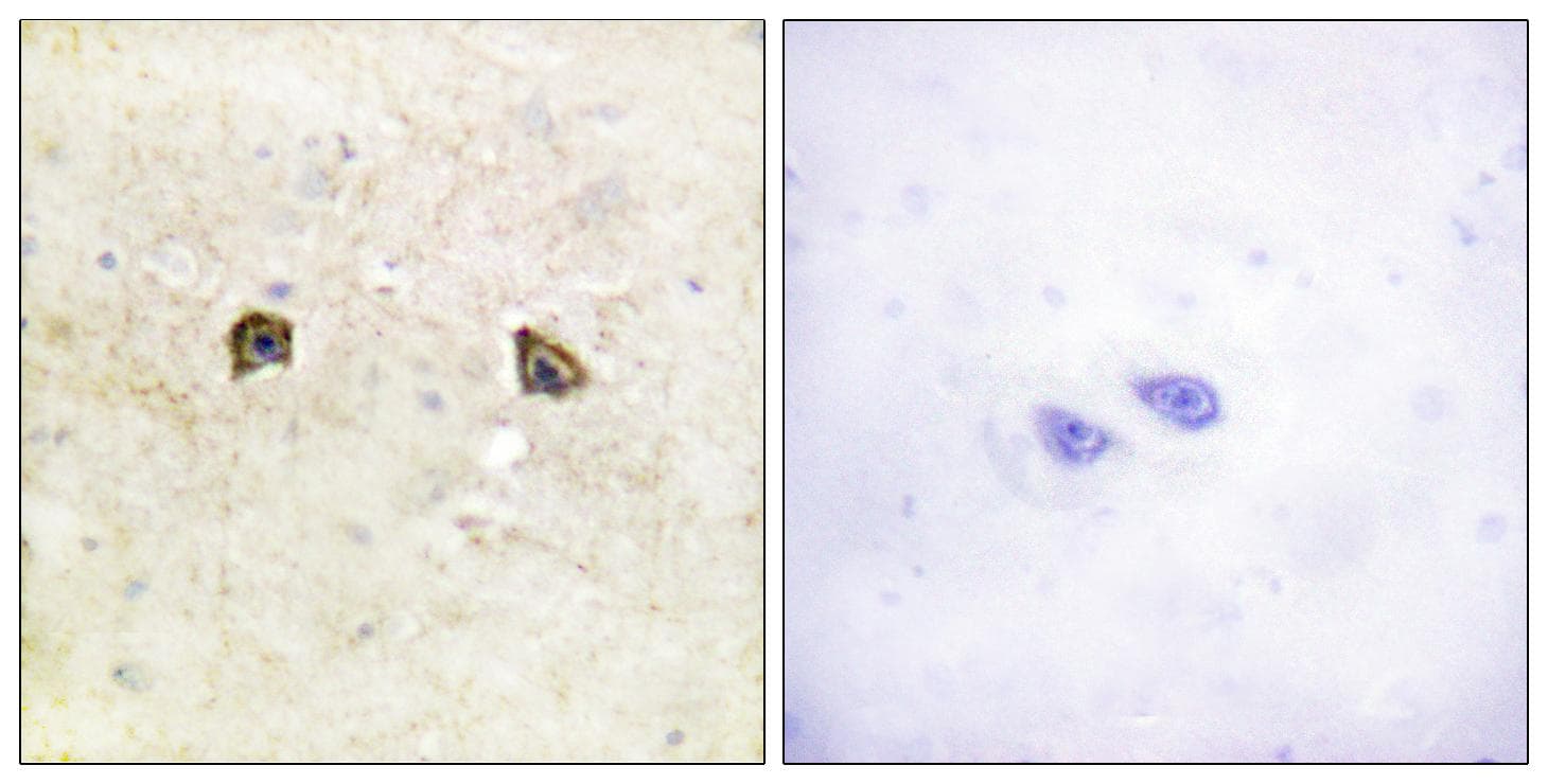 Ephrin B1+B2 Antibody (p594/604)