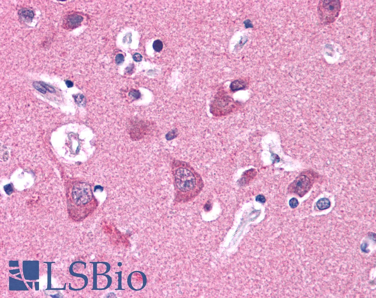 IHC-plus™ Monoclonal Mouse anti-Human TUBB3 / Tubulin Beta 3 Antibody (clone TU-20, C-Terminus, IHC, WB)