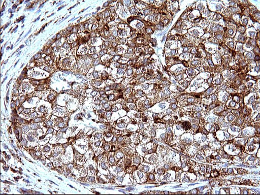 Monoclonal Mouse anti-Human SCAMP2 Antibody (clone OTI1H10, IHC, WB)
