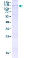 Human TTC14 Protein (Recombinant GST, N-terminus)