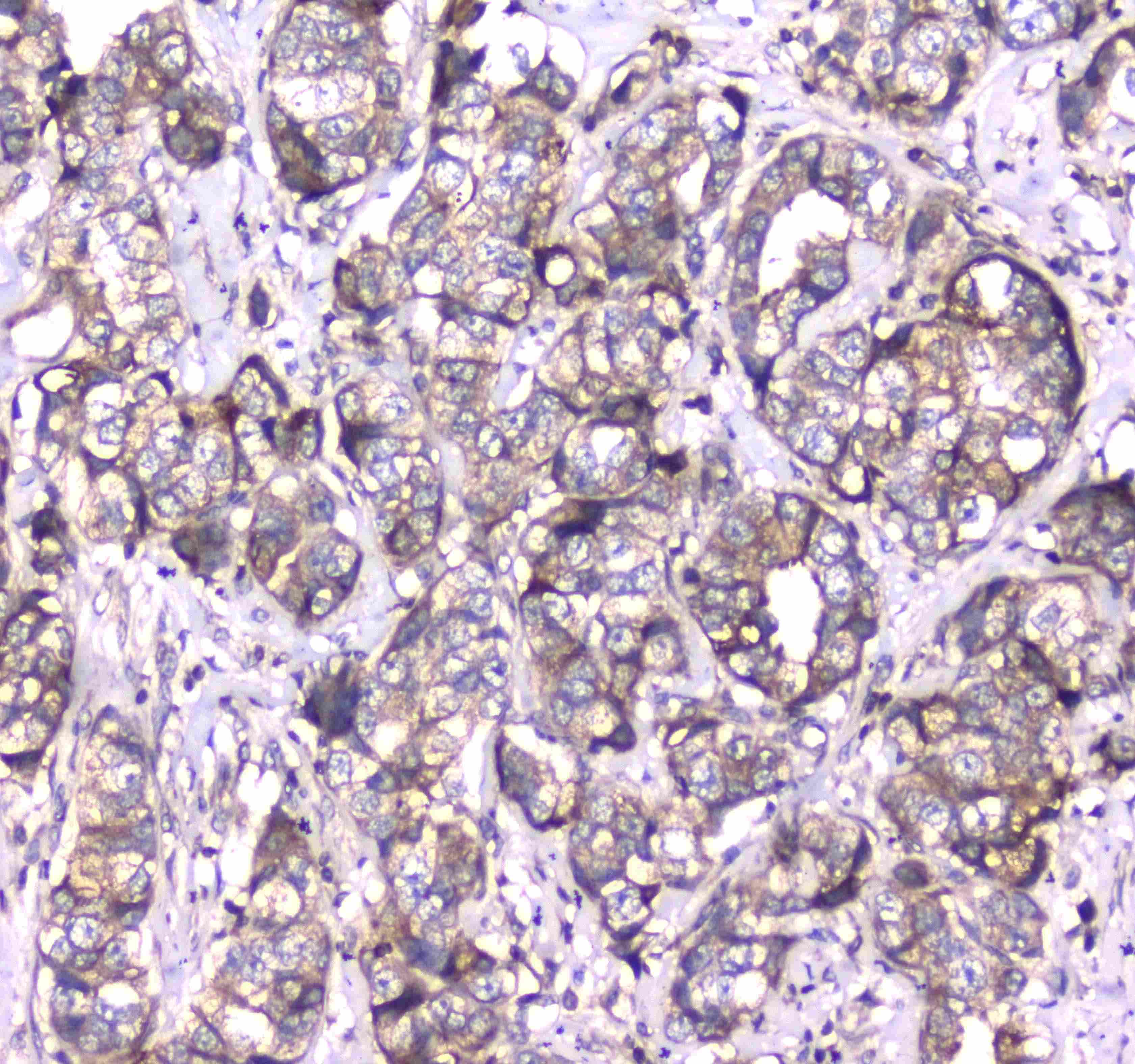 Polyclonal Rabbit anti-Human RAB27A / RAB27 Antibody (IHC, WB)