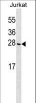 Polyclonal Rabbit anti-Human CGGBP1 Antibody (aa126-152, WB)