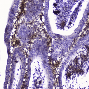 TLN1 / Talin 1 Antibody