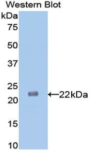Neuraminidase Antibody (aa141-286, Cy3)