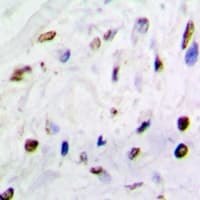 QKI Antibody