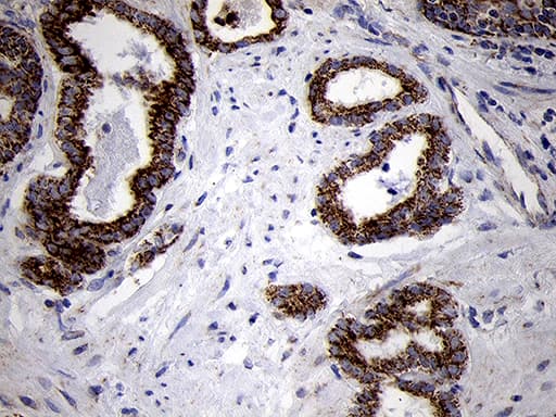 TIMM8A Antibody (clone OTI5C8)