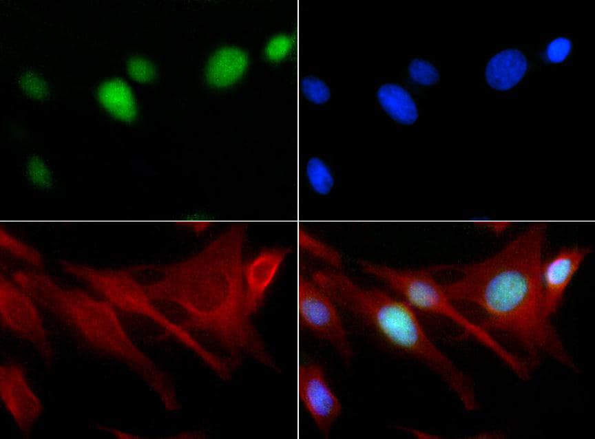 Polyclonal Rabbit anti-Human HIST3H3 Antibody (Me-Lys18, IHC, IF, WB)