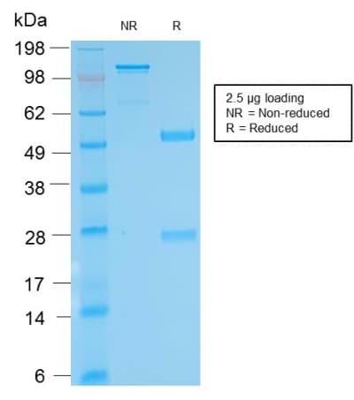 Biotin Antibody (clone BTN/2032R)