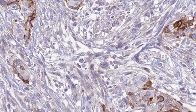 SLC3A1 / ATR1 Antibody