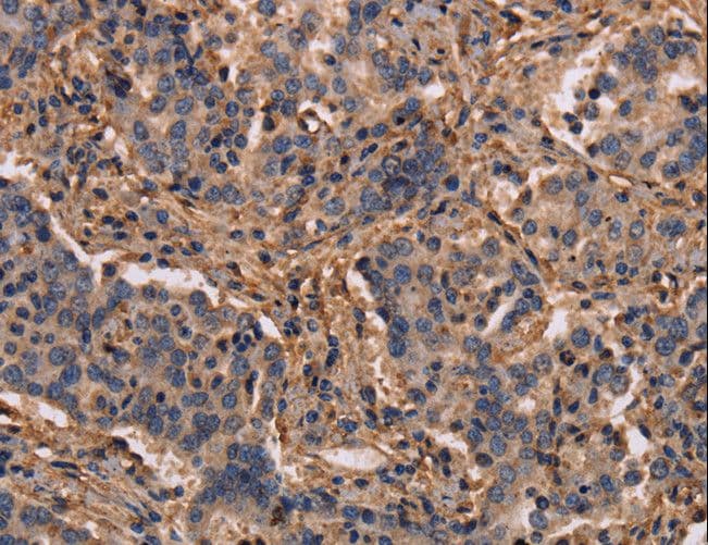 MAP1LC3C / LC3C Antibody