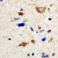 Polyclonal Rabbit anti-Human PKMYT1 Antibody (Internal, IHC, WB)