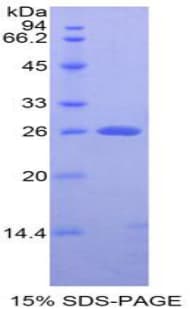 Rat APC Protein (Recombinant His-T7)