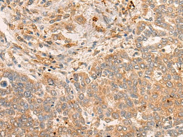 FBXO32 / Fbx32 Antibody