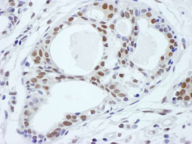Polyclonal Rabbit anti-Human ASH2L / ASH2 Antibody (aa575-C-term, IHC)