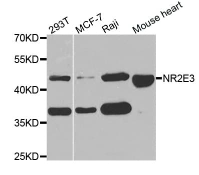 NR2E3 / PNR Antibody