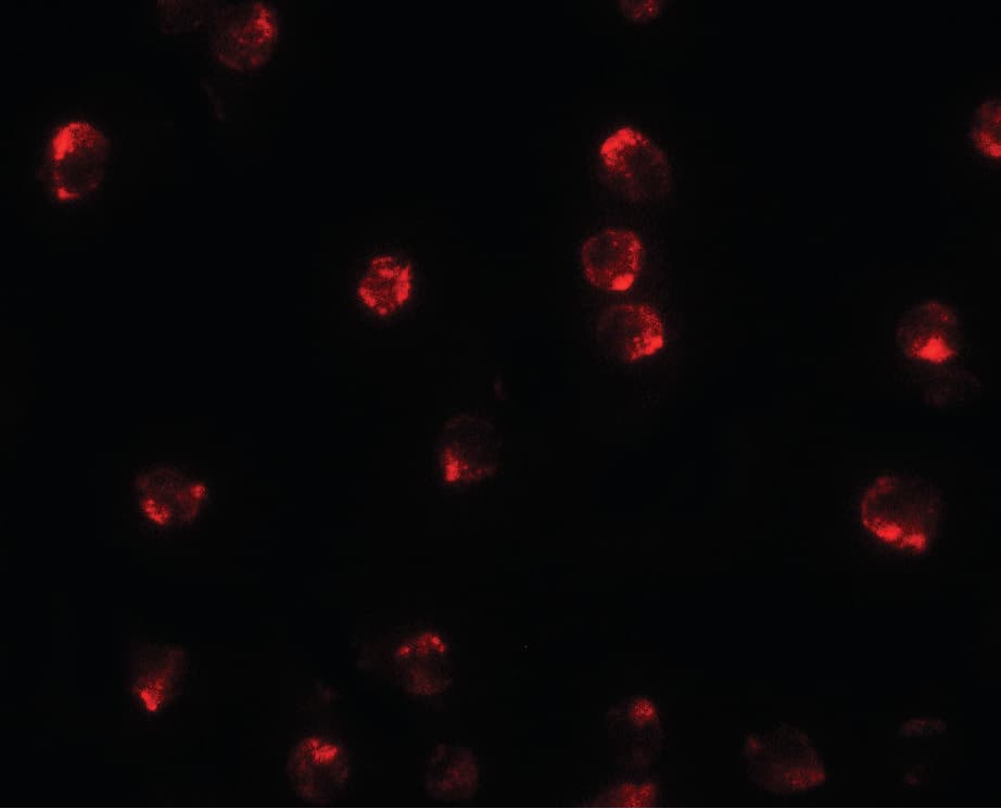 TCTEX1D2 Antibody