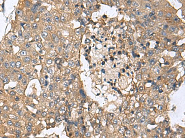 CD59 Antibody