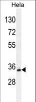 Polyclonal Rabbit anti-Human BCKDHB Antibody (aa41-70, IHC, IF, WB)