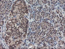 TDO2 Antibody (clone OTI2A4)